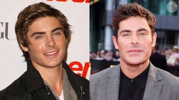 Zac Efron teve que fazer procedimentos no rosto após sofrer um acidente doméstico; assim está o ator hoje em dia