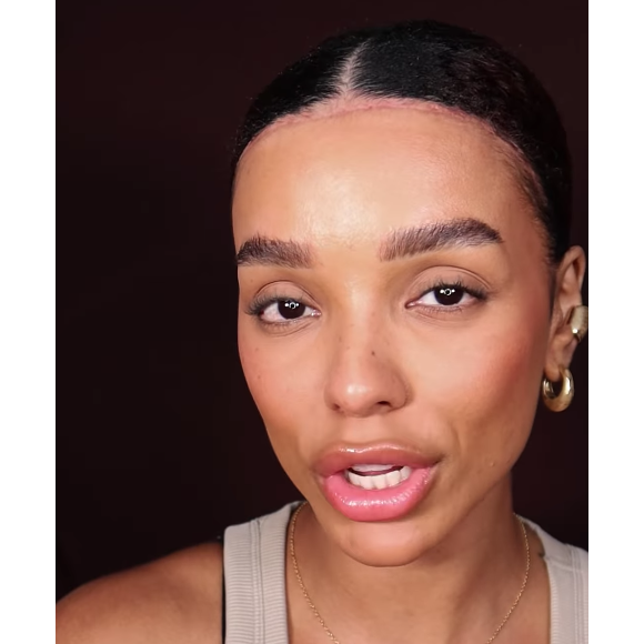 Brunna Gonçalves mostrou a cicatriz de sua cirurgia na web