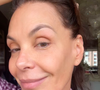 Nos stories do Instagram, Carolina Ferraz rebateu as críticas e mostrou uma pele impecável