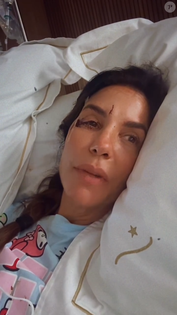 Ivete Sangalo passou por uma cirurgia neste domingo (01), dias após sofrer um desmaio em casa e ferir o rosto em decorrência de um quadro de diarreia