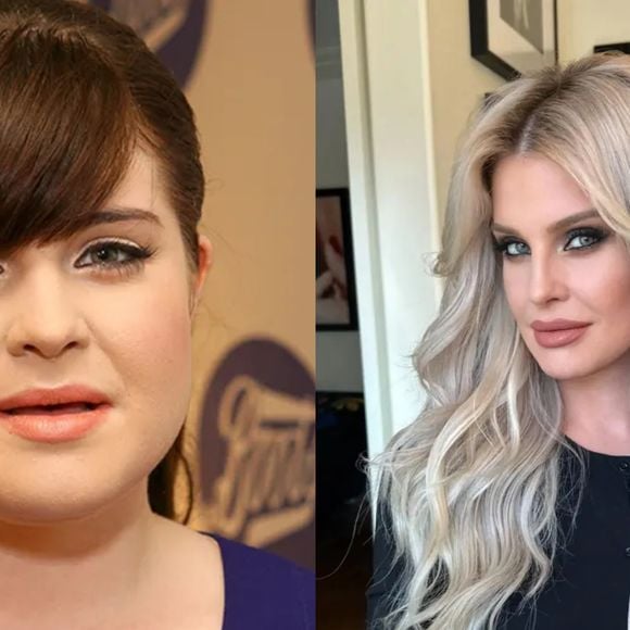 Desde que a filha de Sharon  e Ozzy Osbourne perdeu uma quantidade significativa de peso alguns anos atrás, os fãs se perguntam se ela fez alguma cirurgia no rosto — um boato que ela agora está apagando de uma vez por todas.