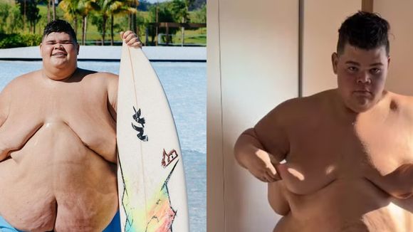 De 350 kg para 220 kg: influenciador Gordão da XJ choca web ao compartilhar antes e depois do corpo após perder 130 kg; veja a transformação em 20 fotos!