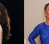 Médico faz alerta sobre doença incurável que afeta Isis Valverde e Ivete Sangalo: 'O diagnóstico tardio pode levar a complicações importantes'