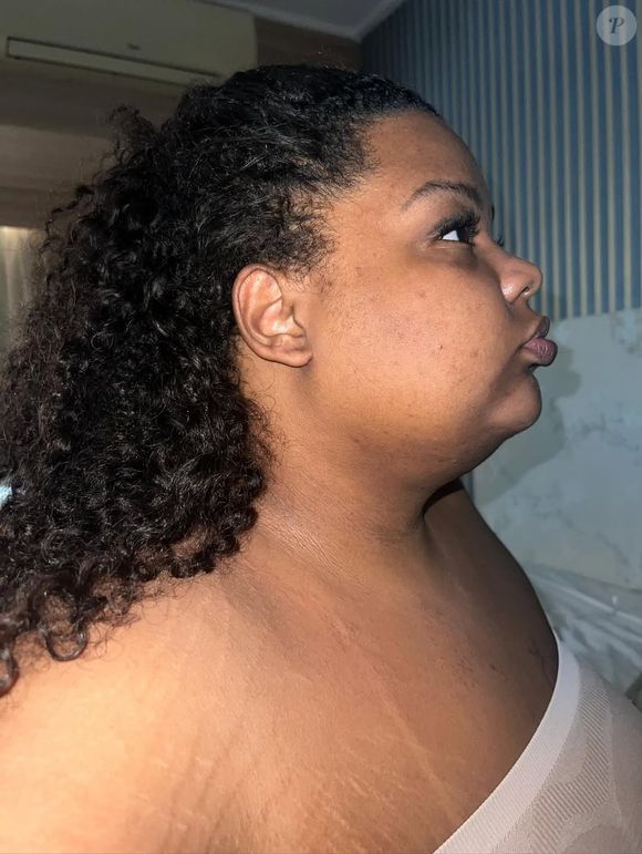 MC Carol reforça importância do processo e afasta ideia de milagre estético