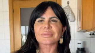 Gretchen estreia 'novo rosto' após procedimentos, é comparada com famosa e resultado agrada público: 'Agora sim, acertou a mão’. Veja antes e depois!
