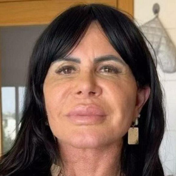 Gretchen estreia 'novo rosto' após procedimentos, é comparada com famosa e resultado agrada público: 'Agora sim, acertou a mão’. Veja antes e depois!