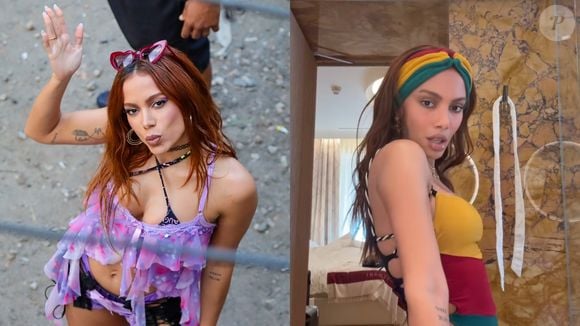 Antes e depois de Anitta: cantora causou entre internautas ao surgir irreconhecível com novos procedimentos estéticos no rosto
