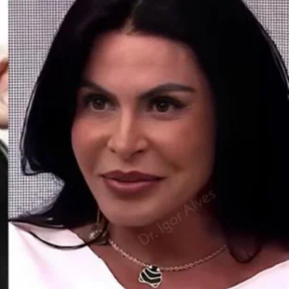 Antes e depois do 'novo rosto' de Gretchen viraliza e cantora rebate críticas de mulheres: “Recalcadas e frustradas”