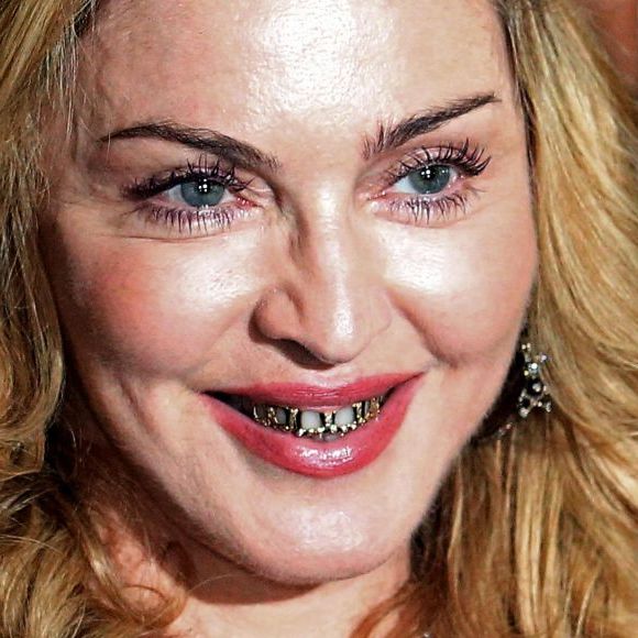 Além disso, suas pálpebras parecem lisas e sem as típicas marcas de envelhecimento, possivelmente evidência de cirurgia para remoção de pele excessiva ou lipofilling.