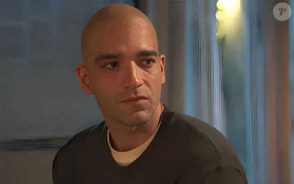 Após descobrir a leucemia, Afonso raspou a cabeça - embora Humberto tenha usado próteses durante todo este tempo