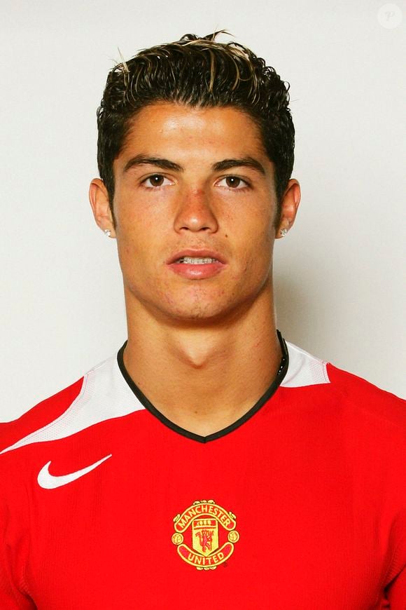 Cristiano Ronaldo tinha um dente a menos na parte da frente de sua boca, o que o incomodava
