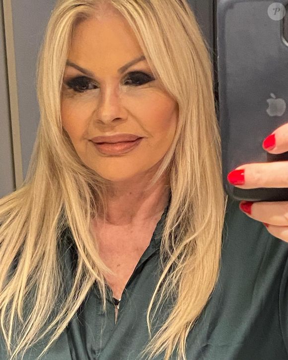 Monique Evans rosto: apresentadora famosa faz procedimento estético. Descubra qual foi!
