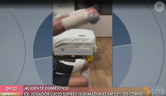 No 'Encontro', com a apresentadora Patrícia Poeta, Lúcio comentou sobre o ocorrido, e ainda enfatizou que a esposa Marília foi fundamental.