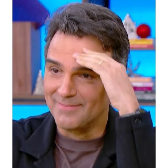 Tadeu Schmidt exibiu visual mais cheio de cabelo no 'Mais Você' - transplante capilar não deixa cicatriz e é avaliada caso a caso