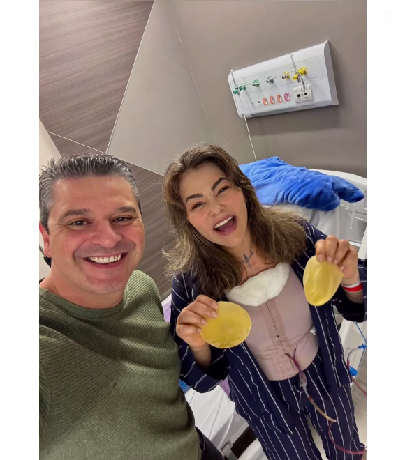 Em comentários, internautas disseram para Suzana Alves tirar também os preenchimentos do rosto