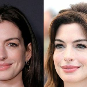 Antes e depois de Anne Hathaway surpreende