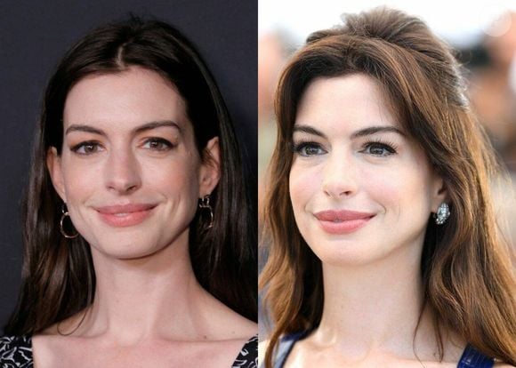 Antes e depois de Anne Hathaway surpreende