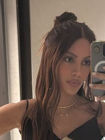 O que Anitta fez no rosto? Cirurgião comenta possíveis procedimentos após cantora aparecer irreconhecível: 'Remove uma faixa de pele'