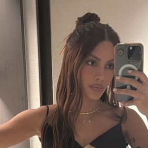 O que Anitta fez no rosto? Cirurgião lista possíveis procedimentos após cantora aparecer irreconhecível na web