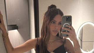 O que Anitta fez no rosto? Cirurgião comenta possíveis procedimentos após cantora aparecer irreconhecível: 'Remove uma faixa de pele'