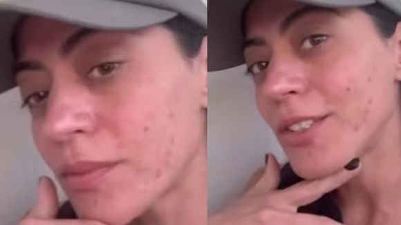 Clarice de 'Garota do Momento', Carol Castro tem doença crônica; médica alerta sobre diagnóstico e cuidados: 'É recomendável evitar...'