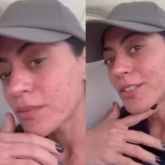 Clarice de 'Garota do Momento', Carol Castro tem doença crônica; médica alerta sobre diagnóstico e cuidados: 'É recomendável evitar...'