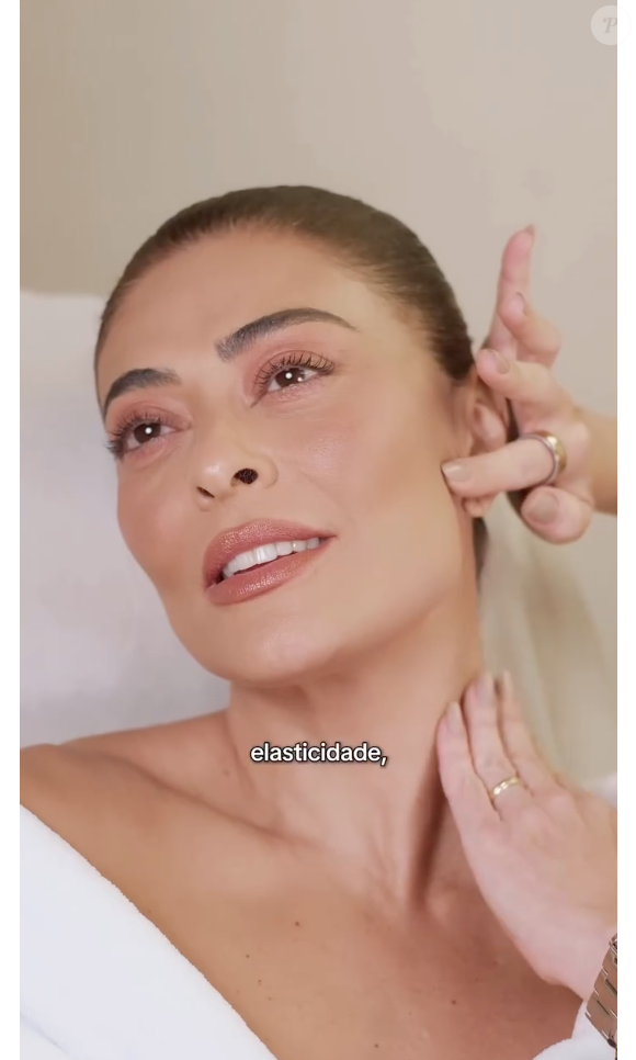 Segredo da pele de Juliana Paes está no Radiesse, um procedimento estético tecnológico para o bioestímulo de colágeno