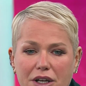 Xuxa sobre o motivo do transplante: "Era uma coisa que eu estava me sentindo mal com aquela carequinha"