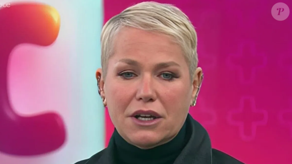 Xuxa sobre o motivo do transplante: "Era uma coisa que eu estava me sentindo mal com aquela carequinha"