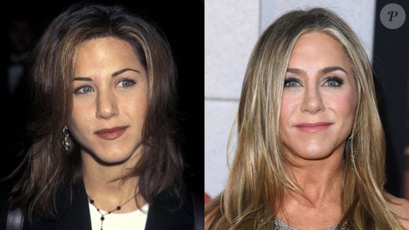 Embora nunca tenha comentado sobre o botox, especialistas garantem que Jeniffer Aniston faz aplicações regulares da toxina