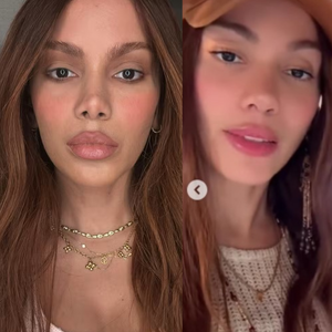 Anitta mexeu no nariz, de novo? Web aponta nova rinoplastia e mudança no rosto da cantora após fotos e vídeos com a xamã Max Tovar. Compare!