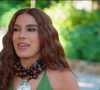 Mudança no olhar de Anitta movimenta especialistas e redes sociais: 'Existe uma leve vermelhidão e uma textura na pele que sugerem um processo de cicatrização recente', afirma Vlassios Marangos