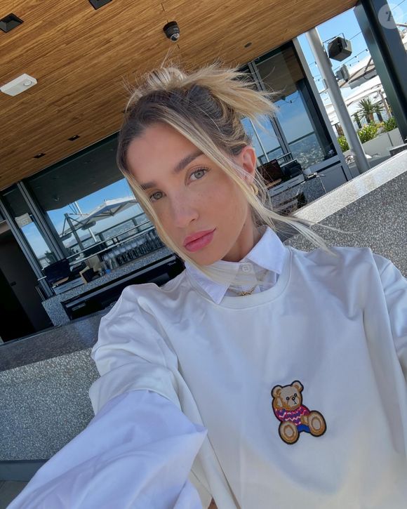 Além do corpo, Aline Gotschalg também fez mudanças em seu rosto