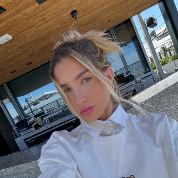 Além do corpo, Aline Gotschalg também fez mudanças em seu rosto