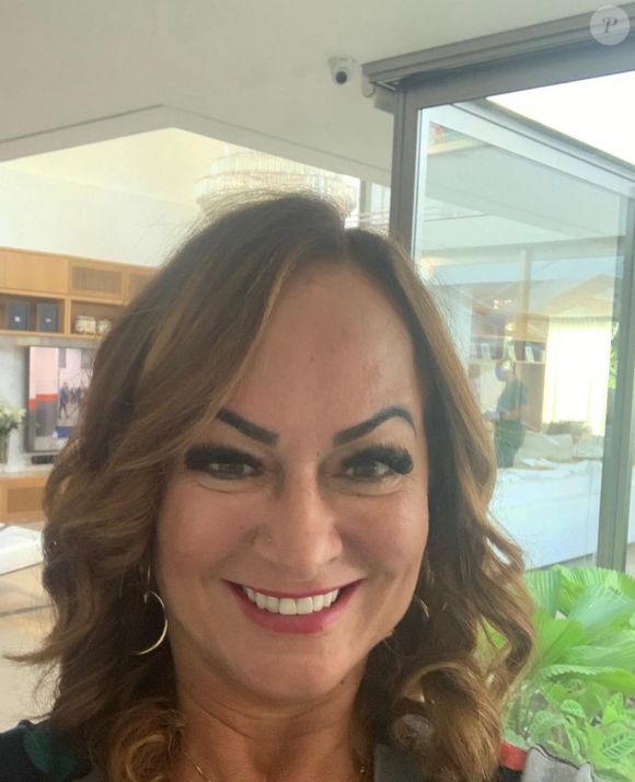 Nadine Gonçalves começou a apostar em procedimentos estéticos há alguns anos