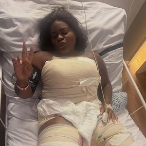 Jojo Todynho realizou mais um combo de cirurgias plásticas após emagrecer 80 kg