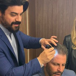 Henri Castelli fez um implante subcutâneo chamado Sihair, que inibe a di-hidrotestosterona (DHT), hormônio responsável pela queda de cabelo