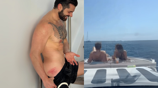 Sem marquinha? Alok mostra 'acidente' no bumbum, mas o que chamou atenção foi outro detalhe no DJ