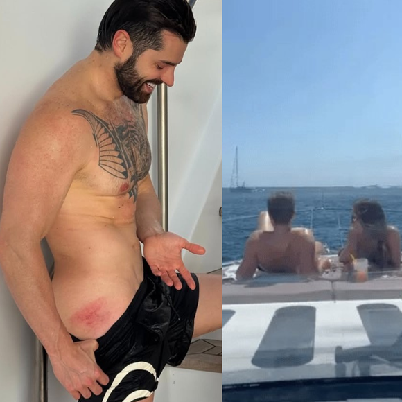 Sem marquinha? Alok mostra 'acidente' no bumbum, mas o que chamou atenção foi outro detalhe no DJ