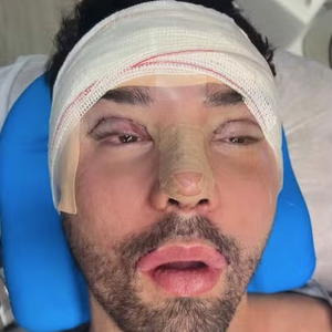 Rico Melquiades vem passando por uma série de operações estéticas nos últimos anos