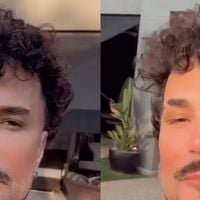 'Só reconheci quando li o nome': Latino surge irreconhecível em vídeo após procedimentos estéticos e antes e depois deixa web em choque. Veja!