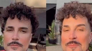 'Só reconheci quando li o nome': Latino surge irreconhecível em vídeo após procedimentos estéticos e antes e depois deixa web em choque. Veja!