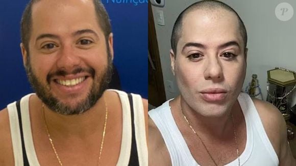 Antes e depois de Hugo, dupla de Tiago: cantor sertanejo causou ao aparecer irreconhecível na web, mas revelou ter usado apenas filtro