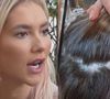 Virgínia Fonseca revela ter desenvolvido alopecia após polêmica sobre a qualidade da sua base