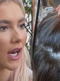 'De novo... Na época da base da Wepink surgiram três': Virginia Fonseca volta a enfrentar diagnóstico de alopecia, faz tratamento e revela alerta de médico