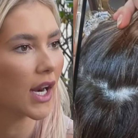 Virgínia Fonseca revela ter desenvolvido alopecia após polêmica sobre a qualidade da sua base