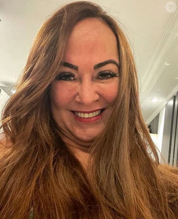 Entre os procedimentos já feitos por Nadine Gonçalves estão os injetáveis