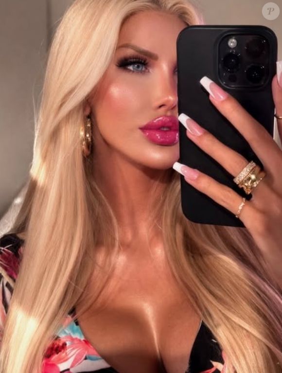 Nikki Exotika quase desmaiou em apresentação e ao ser levada para consultório de cardiologista teve um ataque no coração