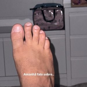 Marido da cantora Simone Mendes, Kaká Diniz apresentou lesão no tornozelo