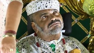 Urgente! Morre Arlindo Cruz, aos 66 anos: sambista lidava com sequelas graves de AVC isquêmico desde 2017